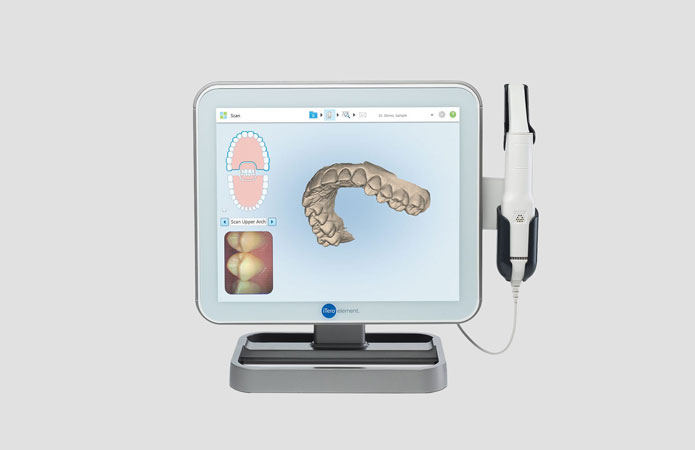  iTero digital scanner – the future of orthodontics