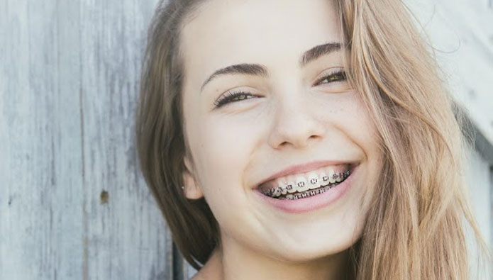  Who are fixed braces for?